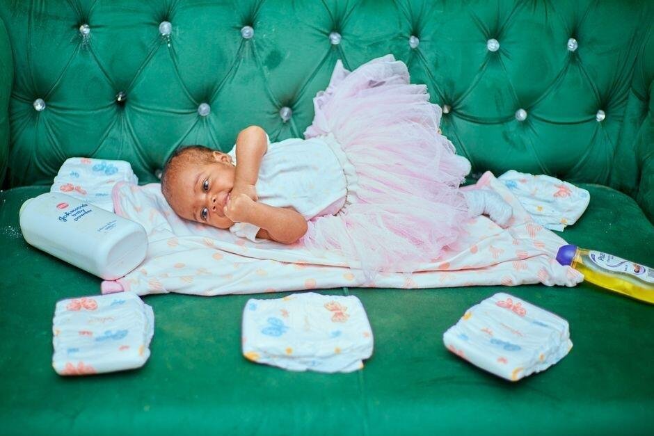 Apa Itu Hypoallergenic? Ini Pentingnya untuk Kulit Bayi Apa Itu Hypoallergenic? Ini Pentingnya untuk Kulit Bayi
